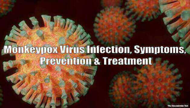What is Monkeypox Virus?