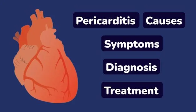 Pericarditis, Causes, Symptoms, Diagnosis And Treatment